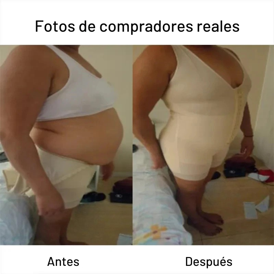 Antes_8.png